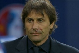Il goal italiano era talmente inaspettato che, in preda all'esultanza, Zaza ha colpito al volto Conte, facendolo sanguinare